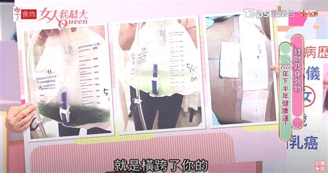 乳暈生毛|乳頭邊上長毛，有沒有問題？能拔掉嗎？